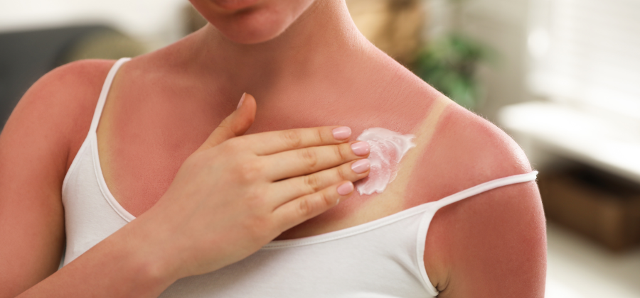 aloe vera body lotion