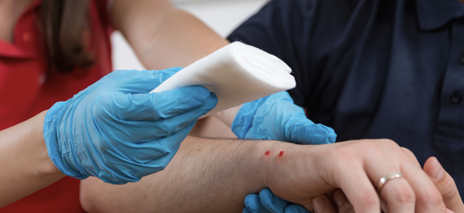 Animal bites on hand.