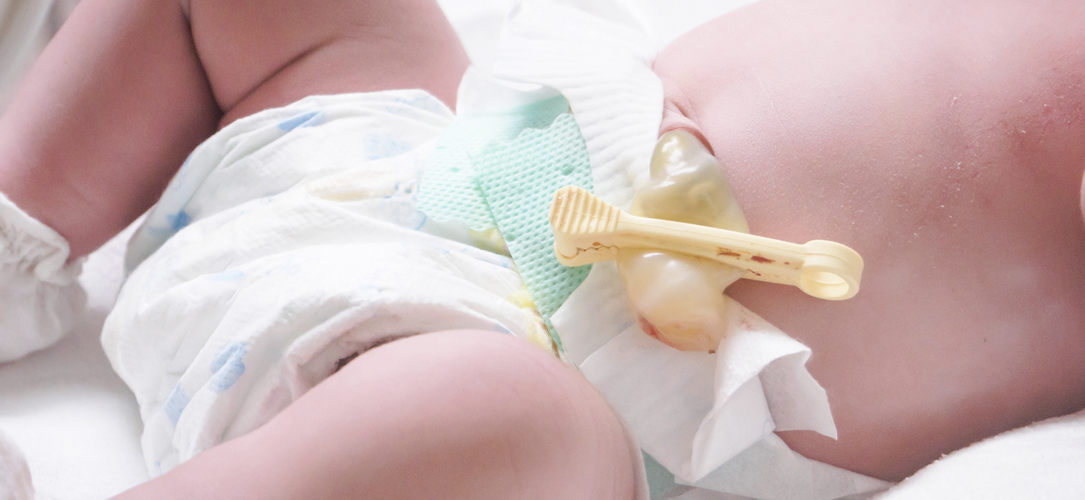 umbilical Cord Clampes.