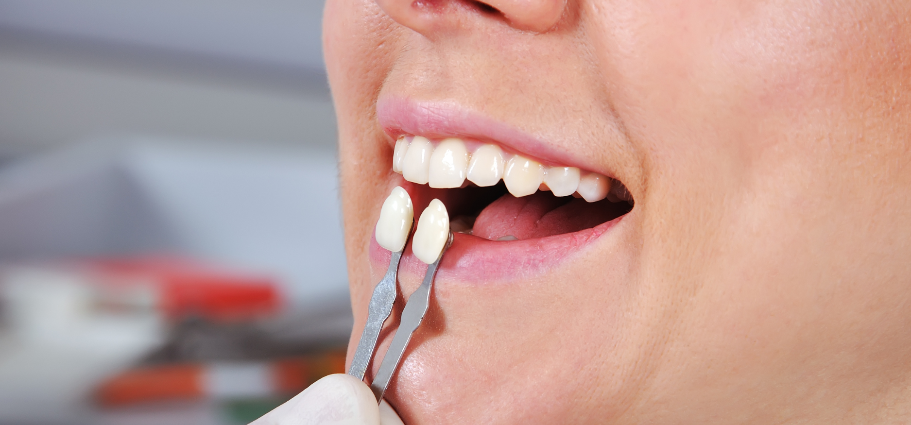 dental crown