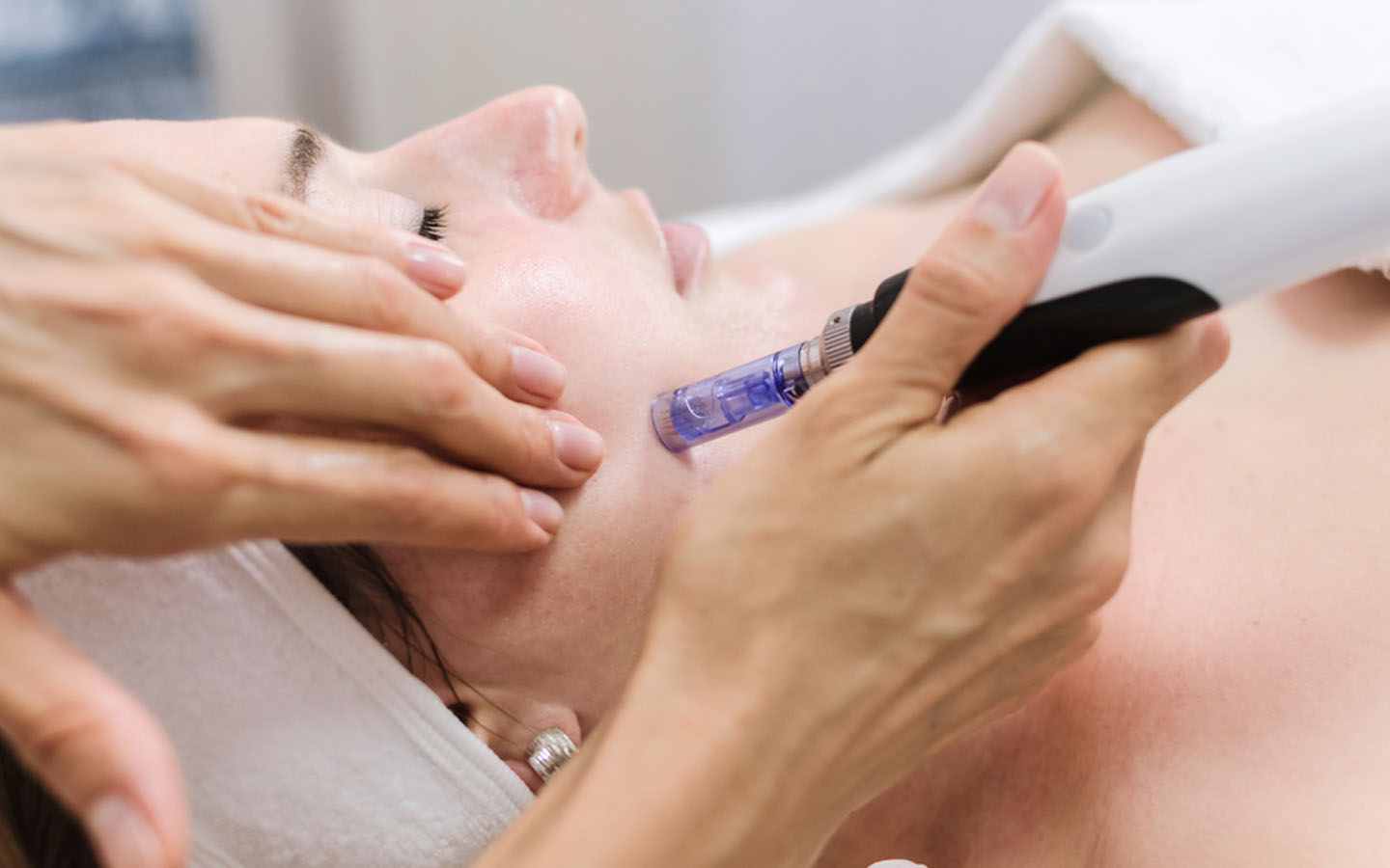 Treatment with skin needling