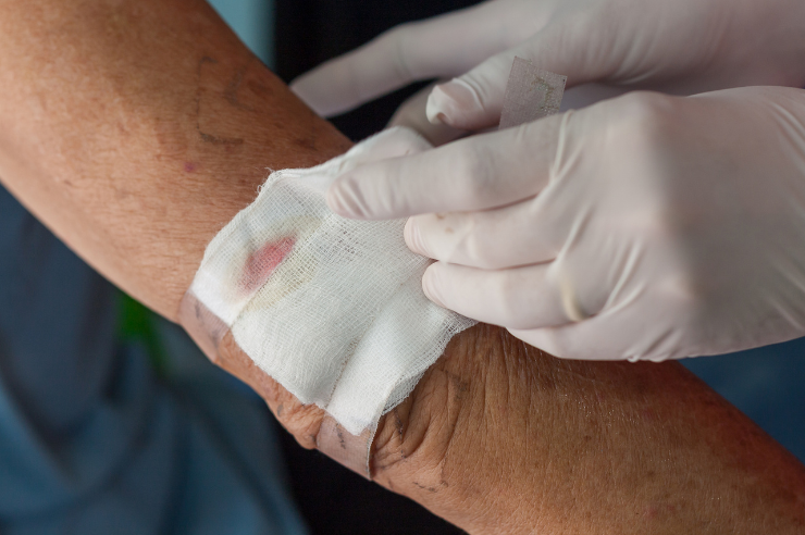 Wound Dressing Pads