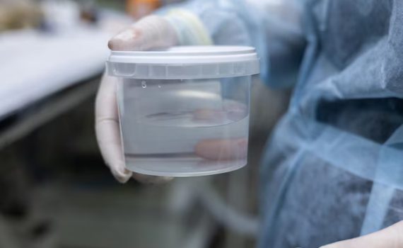 Transparent Container