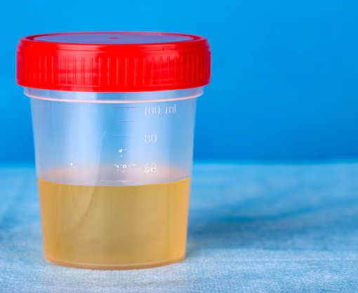 Screw Cap Urine Container