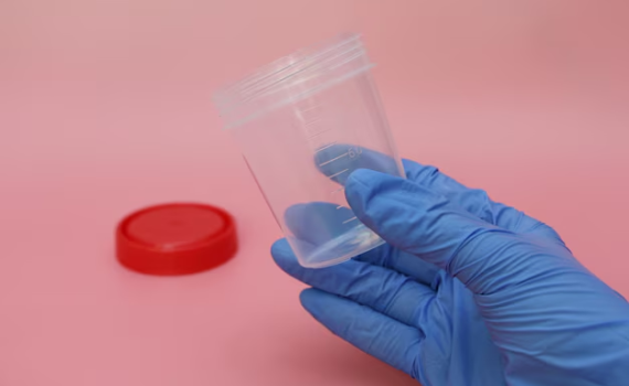 Screw cap Containers