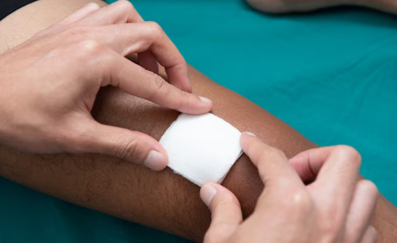 Non adherent dressing for burns