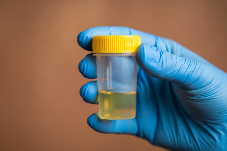 Surgical Transparent Containers