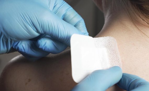 Sterile Absorbent Dressing