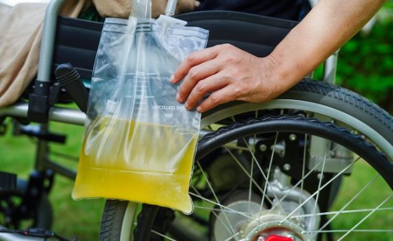 urine bag