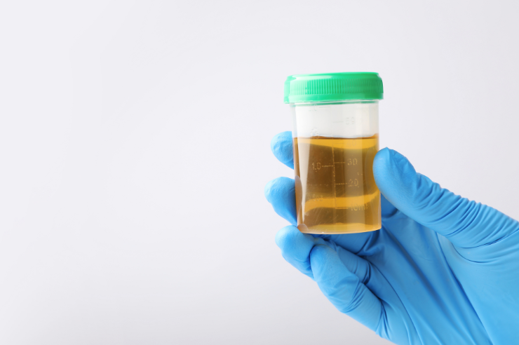 Urine Container