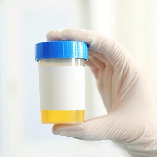 urine container