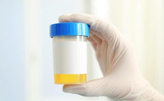 urine container
