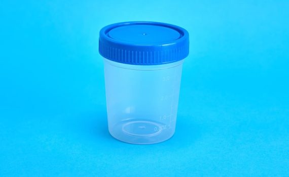 urine container​