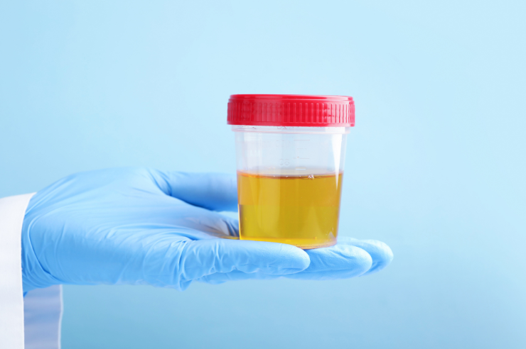 Urine Container
