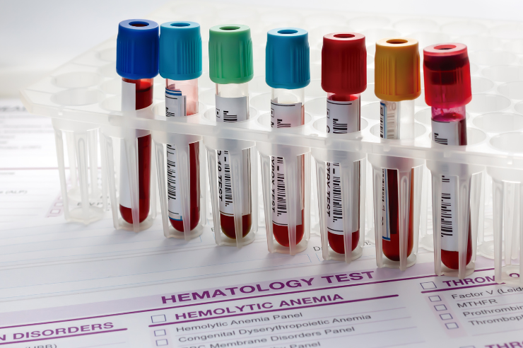 Blood Collection Tubes