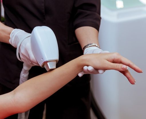 laser hair removal