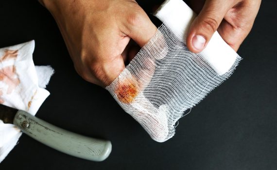 gauze swabs​