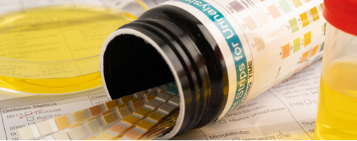 Urine reagent test strips for urinalysis