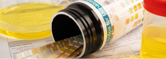 Urine reagent test strips for urinalysis