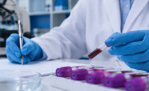 Blood sample testing in a clinical diagnostic laboratory