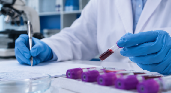 Blood sample testing in a clinical diagnostic laboratory