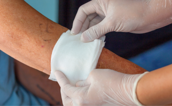 Clinician placing dressing on wounded arm