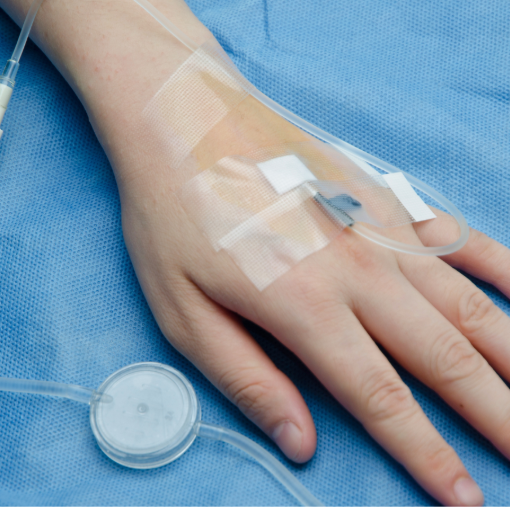 Arm with IV catheter attached
