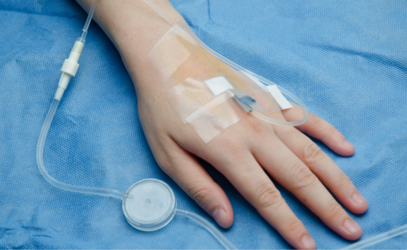 Arm with IV catheter attached